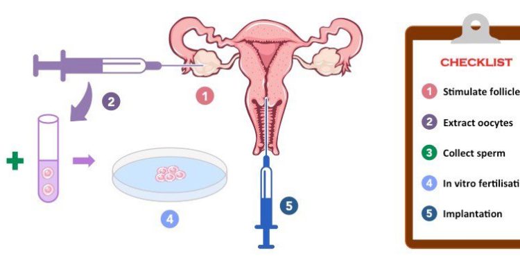 Purpose, Process and Cost of In-vitro Fertilisation Treatment | Away ...